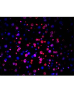 TUNEL Andy Fluor™ 594 Apoptosis Detection Kit